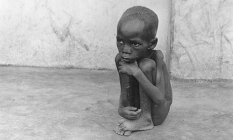 A starving Biafran child, pictured in 1968.   Photograph: Partington/Getty Images