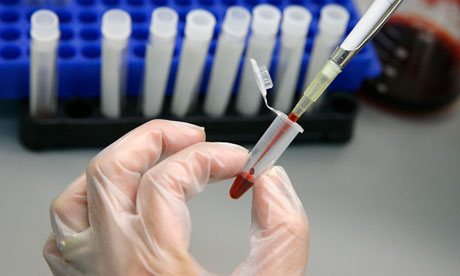 HIV testing during early infection may reduce new cases in high-risk communities