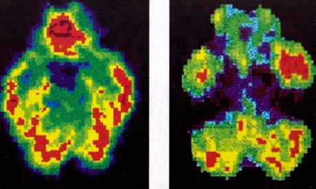 Scans-of-a-normal-brain-l-008