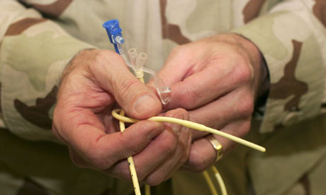 The US knows force-feeding hunger strikers at Guantánamo is illegal