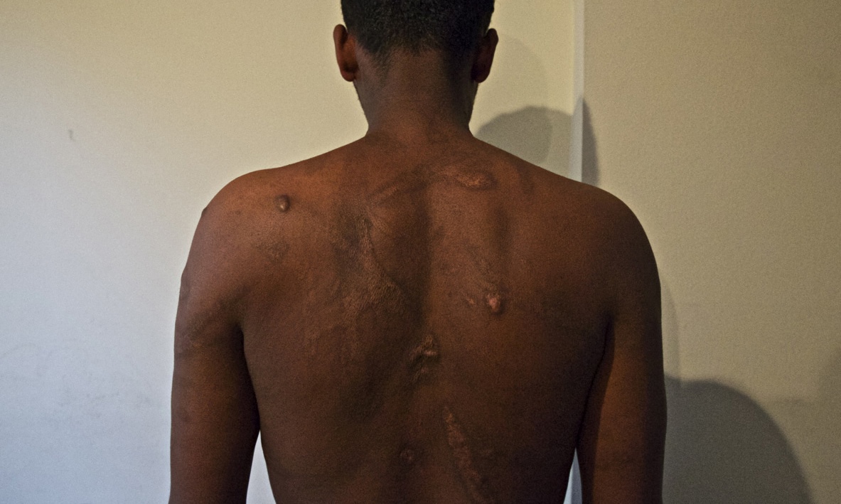 Hundreds Of Eritreans Enslaved In Torture Camps In Sudan And Egypt 