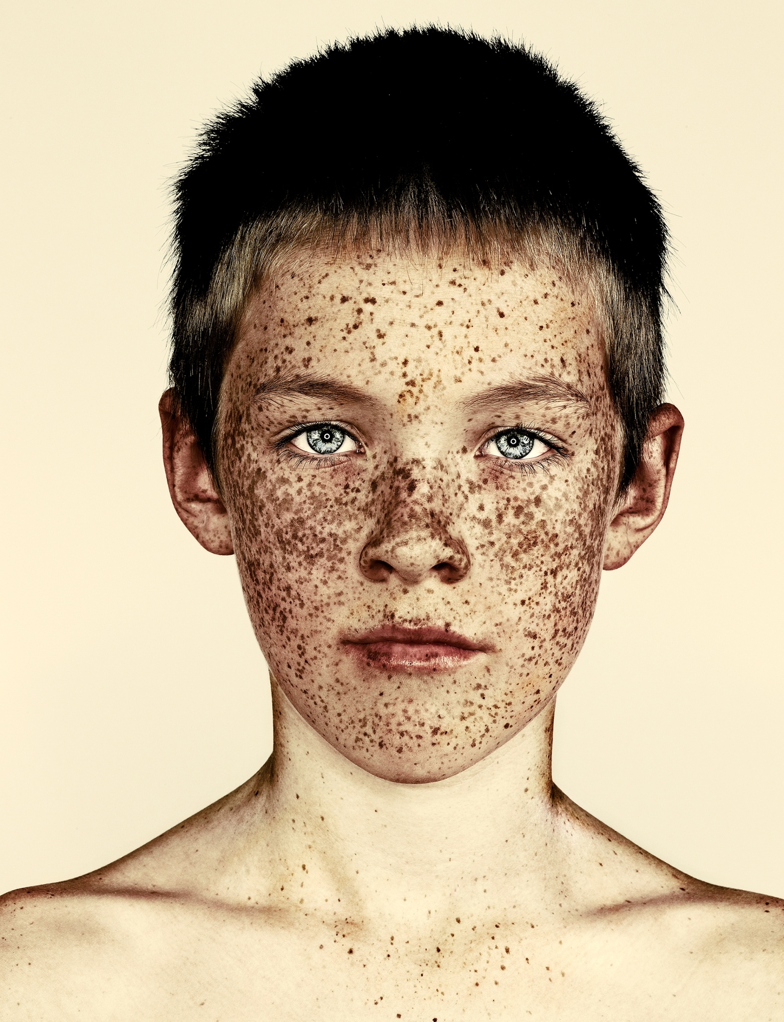 Freckles Brock Elbanks Striking Portraits In Pictures Art And 