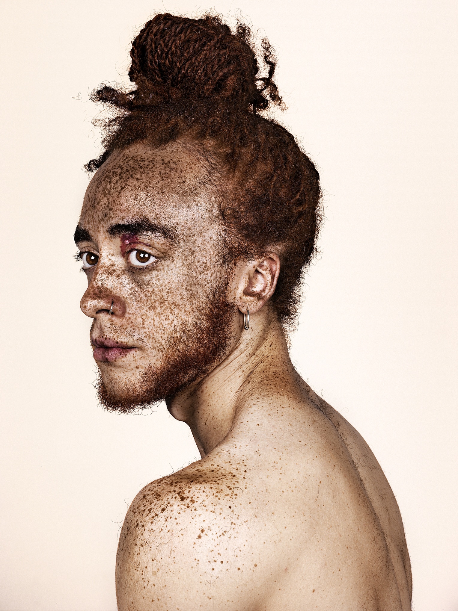 Freckles Brock Elbank S Striking Portraits In Pictures Art And