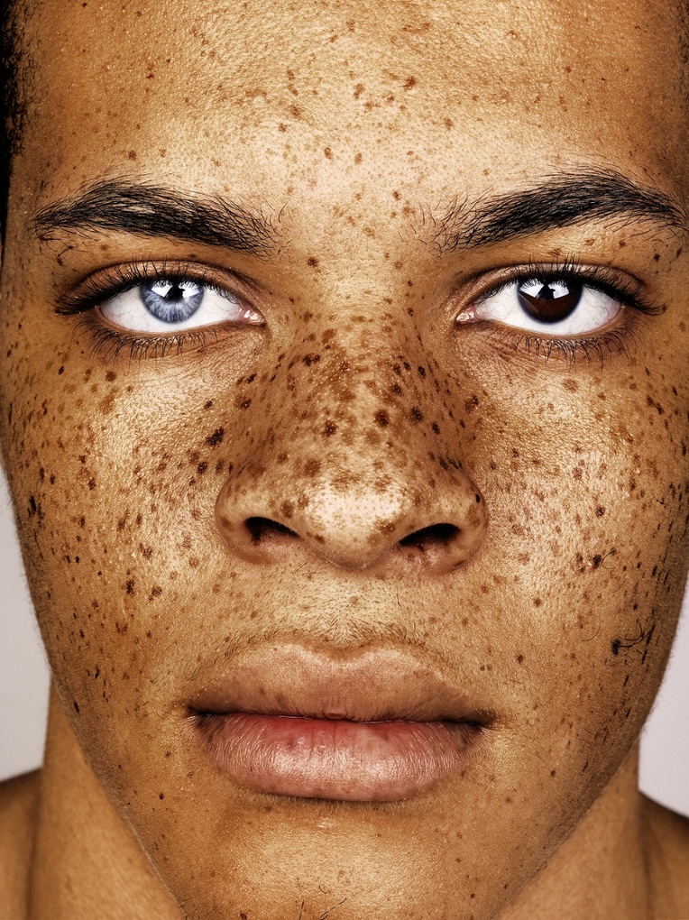 Freckles Brock Elbanks Striking Portraits In Pictures Art And 