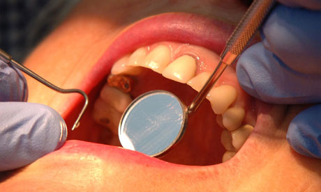 for sugar wounds treating used of in Hands the Invisalign Was Barber When Reviews Dentistry the for sugar wounds treating used of in Hands the Invisalign Was Barber When Reviews Dentistry the